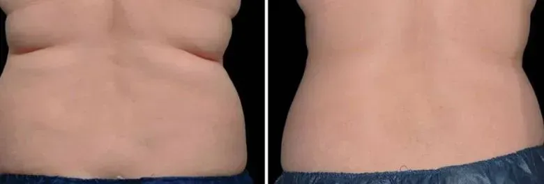 Resultat fettreducering