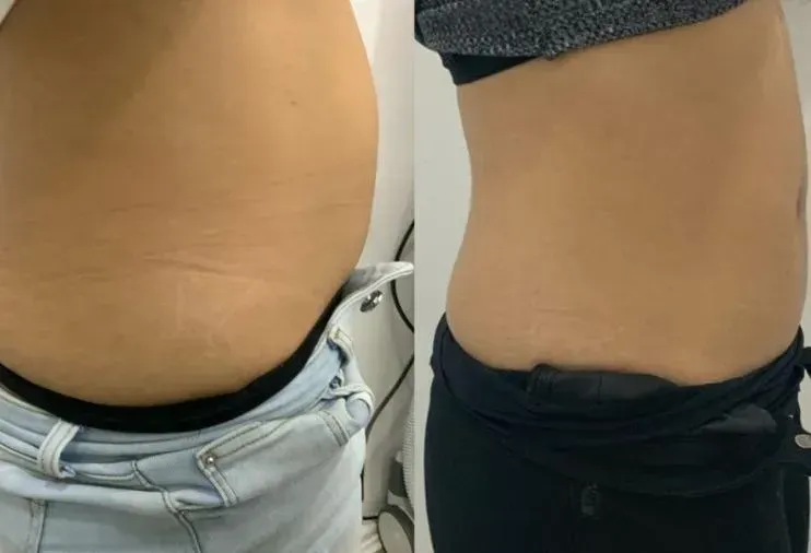 Resultat fettreducering
