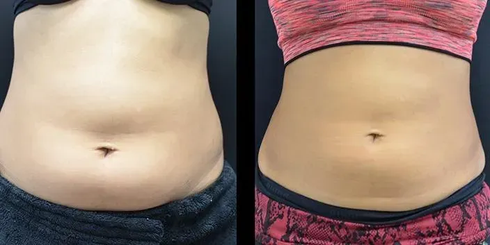 Resultat fettreducering